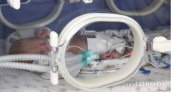 В Коми госпитализировали младенца с серьезными травмами