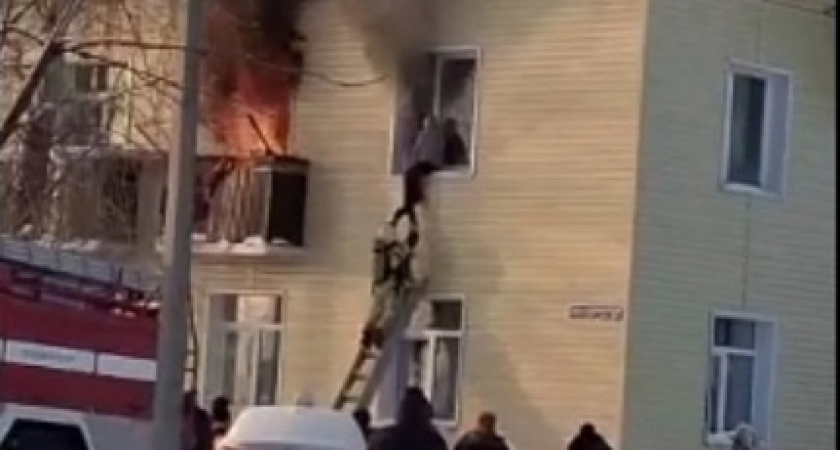 В Ухте женщина пострадала на пожаре в жилом доме