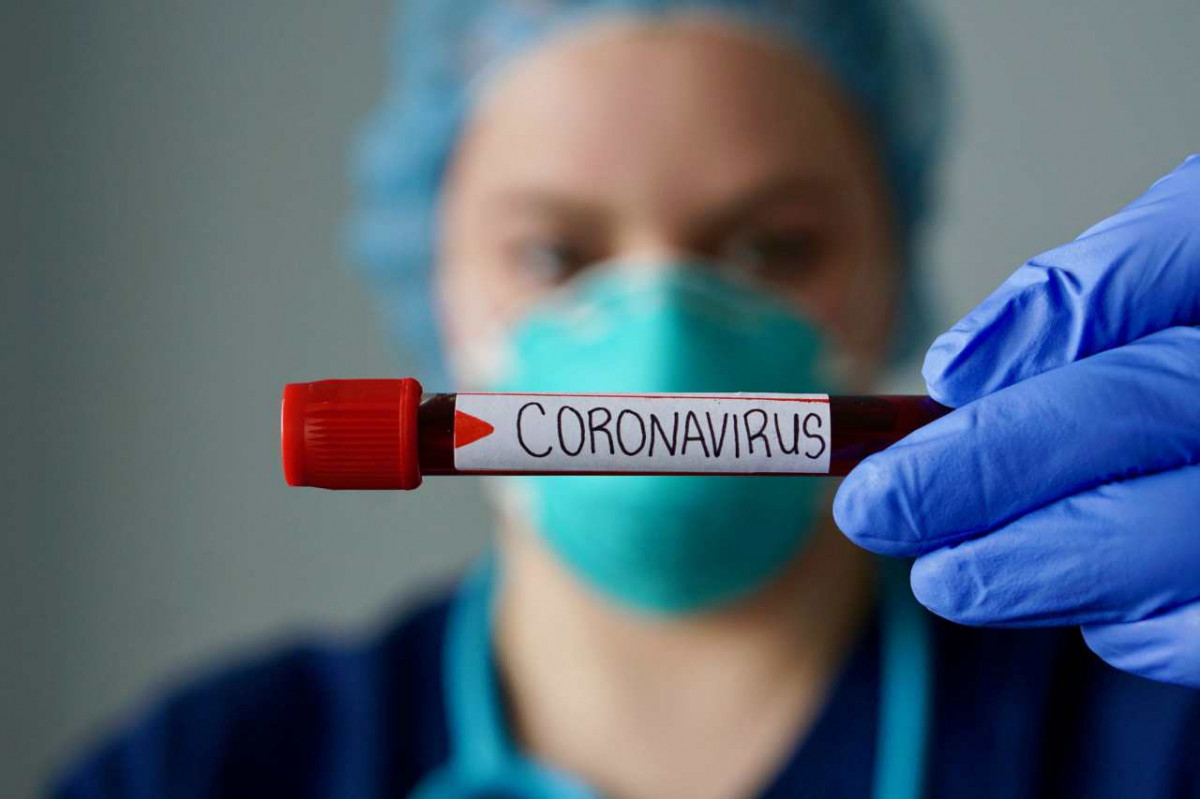 Ученые назвали главные условия прекращения эпидемии коронавируса